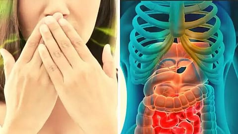mouth health