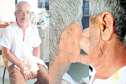 Injured Farmer