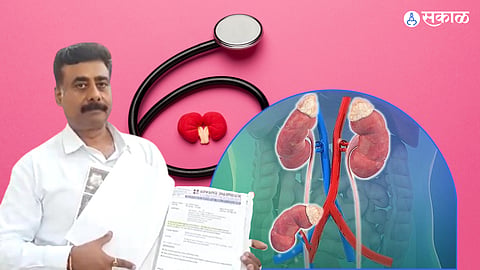 three kidney