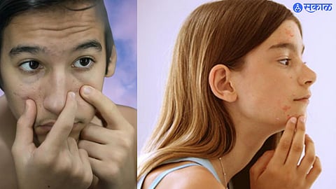 Know early puberty signs in children parents should take care