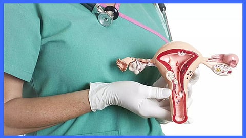 Cervical Cancer