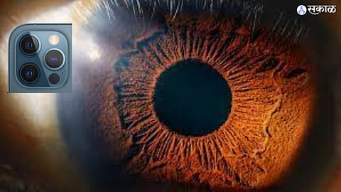 Eye 