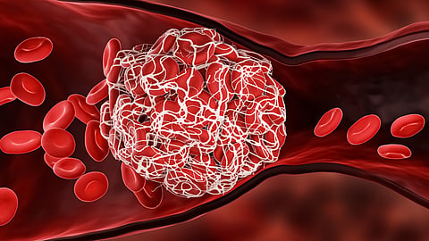 Period clots