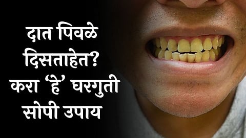yellow teeth