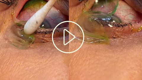 Video Viral