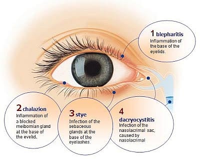 Nashik eye health news