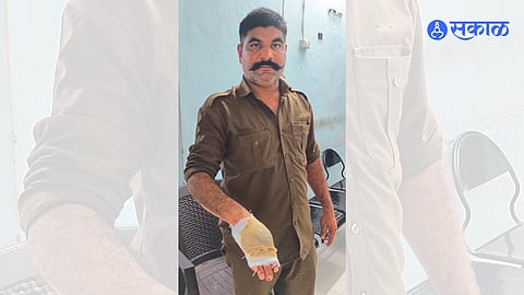 Anup Khairnar, the driver of Kalavan Agar, who was injured in the attack by the youth at wani