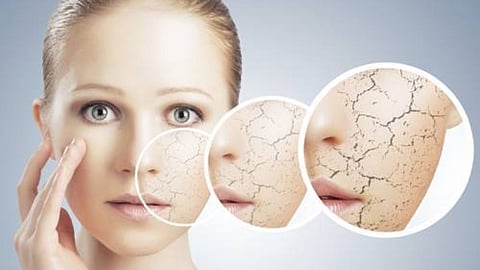winter Skin Care 
