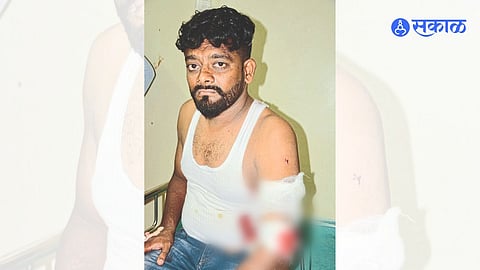 Injured Lalit Chaudhary 