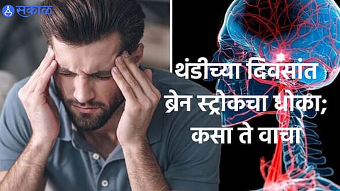Brain Stroke Day