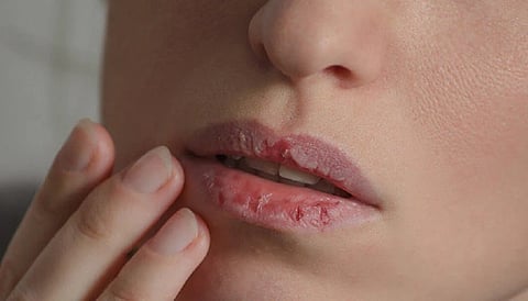 Lips Care Tips 