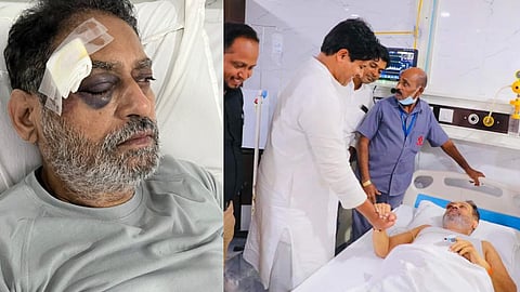 nitin raut on congress bharat jodo yatra  eye injury incident in hyderabad  