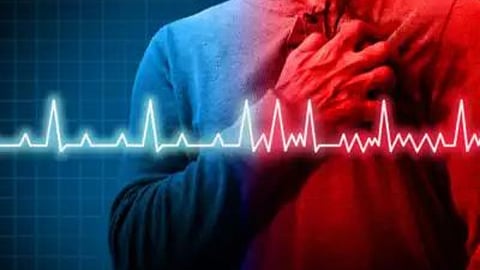 Heart Attack 