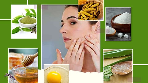 Open Pores Remedies