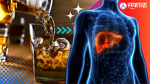 Fatty Liver
