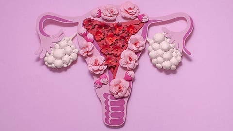 Don'ts of PCOS