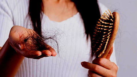 Hair Fall