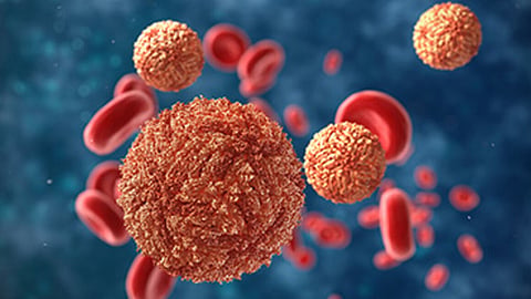 Zika Virus