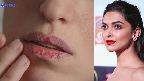 Lip Care Tips