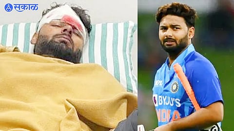 Rishabh Pant
