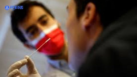 Corona virus 