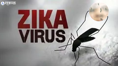 Zika Virus