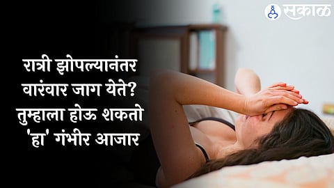 Sleep Disorders 