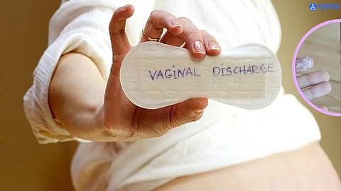 White Discharge 
