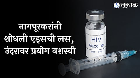 HIV Vaccine