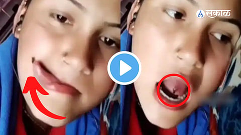 Viral Video