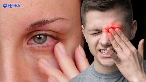 Eye Care Tips