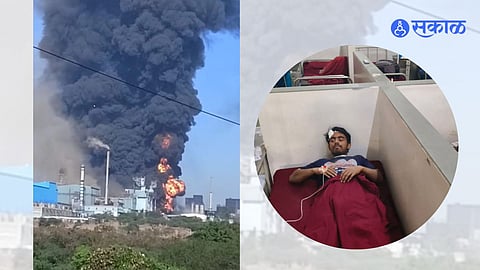 Jindal Fire Accident 