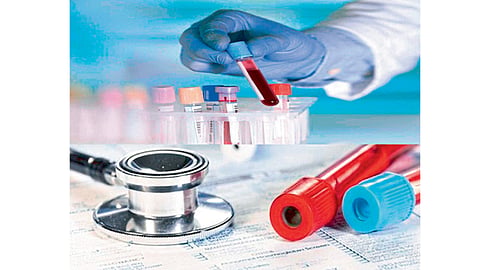 Blood Testing