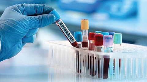 Blood test