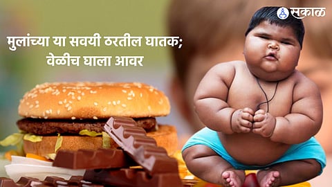 childhood obesity
