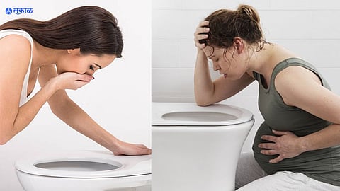 Morning Sickness in Pregnancy