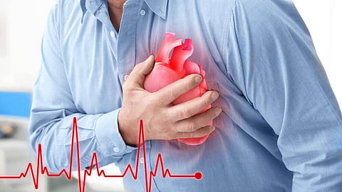 Heart Attack 