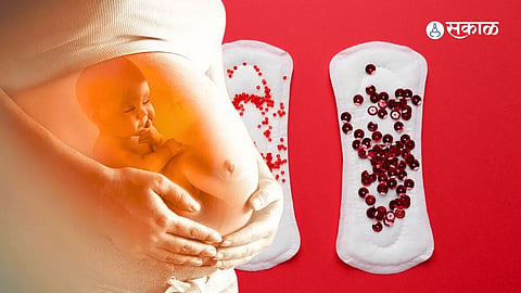 bleeding during pregnancy 