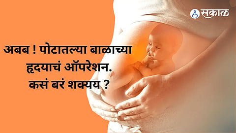 heart surgery of a baby in a  womb
