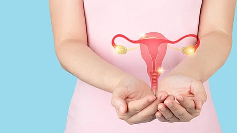 PCOS 