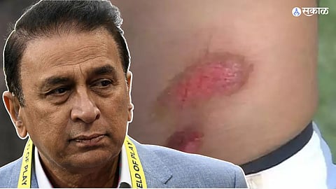 Shubman Gill Sunil Gavaskar IND vs AUS 3rd Test