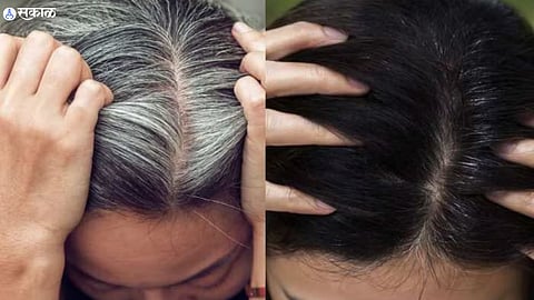 White Hair Issue