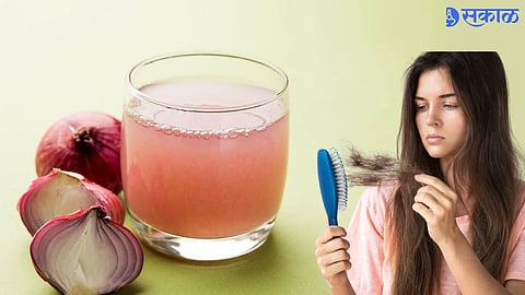 Onion Juice For Hair Growth 