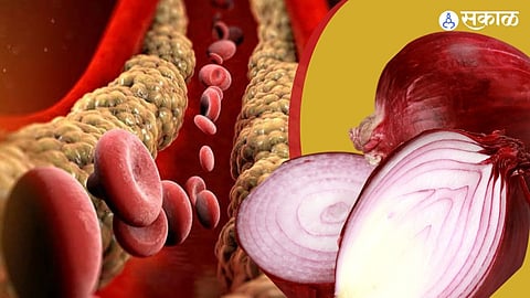 How to reduce cholesterol naturally
