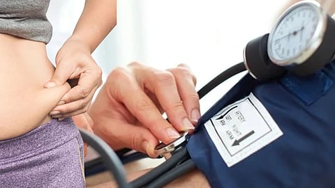 Obesity Hypertension