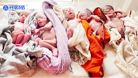 Birth of 5 Baby