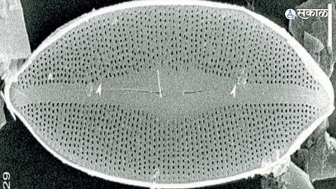new species of Diatoms in Sikkim Aid for medicines for rare diseases