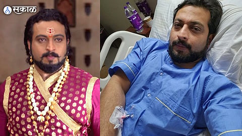 actor dr Amol Kolhe health update after he injured in karad shivputra sambhaji marathi drama play 