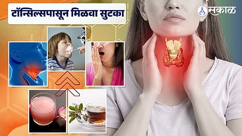 Tonsillitis Symptoms in marathi 