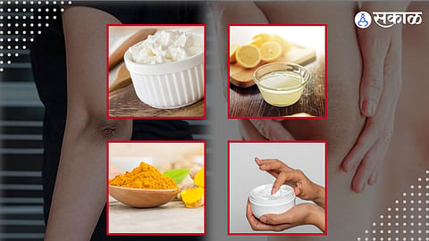 how to get rid of dark knees and elbows